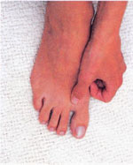 массаж укрепляет иммунитет