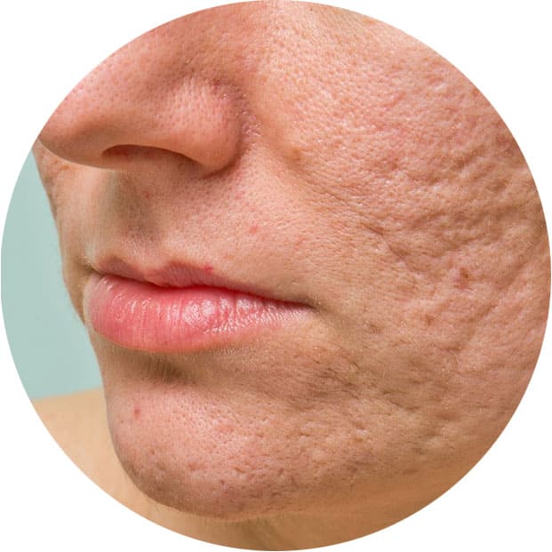 массаж лица