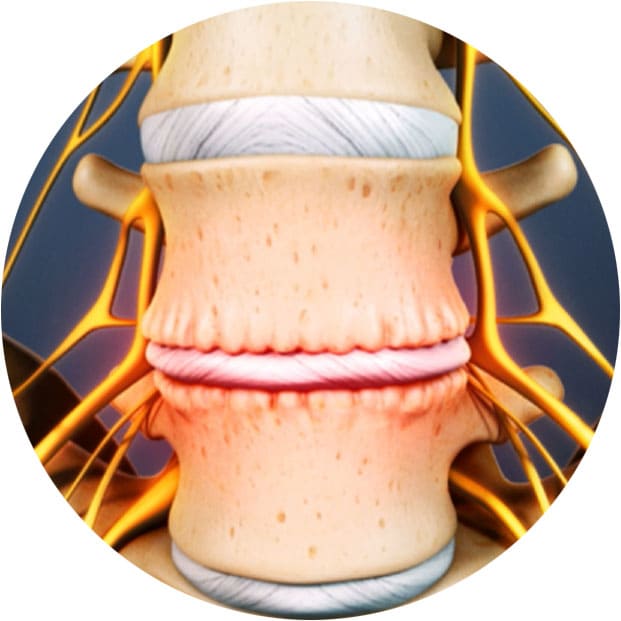 массаж и остеохондроз