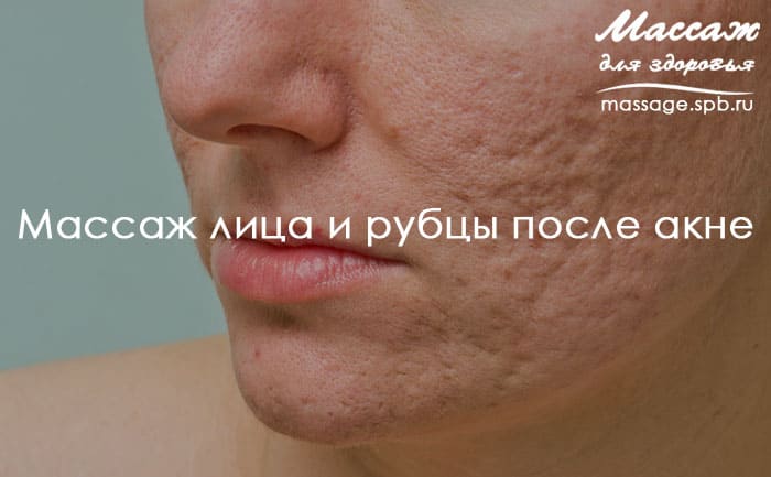 массаж лица