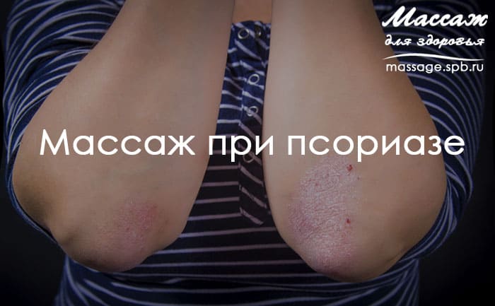 массаж при псориазе