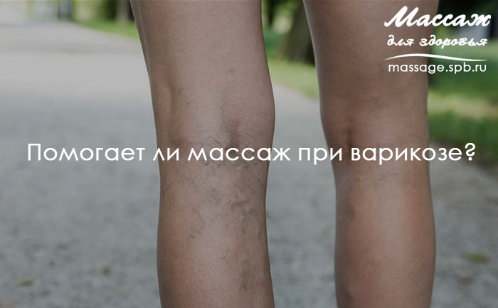варикоз и массаж
